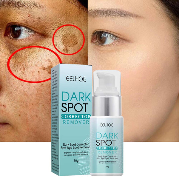 Nicotinamide Whitening Freckle Cream Dark Spot Remover Skin Care Products Moisturizing Brighten Pigment Correction Face Beauty