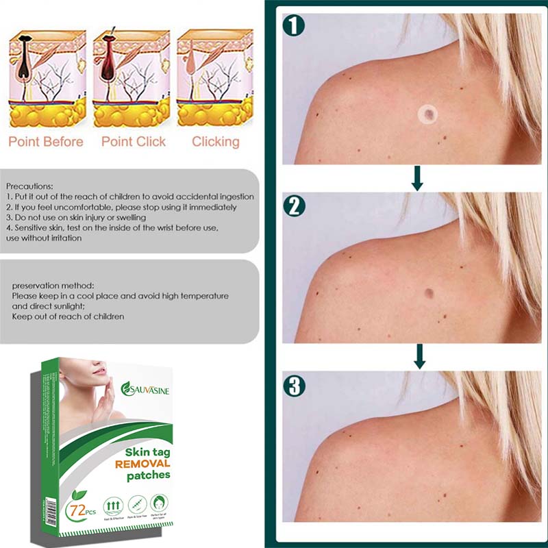 Warts Remover Patch Skin Tag Remover Antibacterial Beauty Tools Quick Treatments Invisible Stickers Safe Skin Care Products